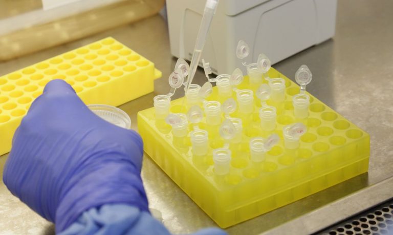 Cientistas identificam proteína que transporta o novo coronavírus