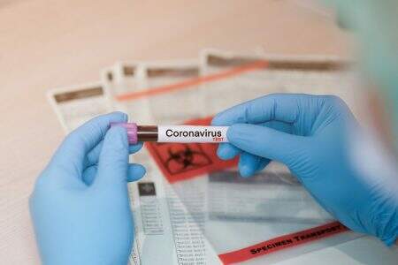 Coronavírus: Jacareí tem 41 óbitos, 736 casos confirmados e 494 recuperados