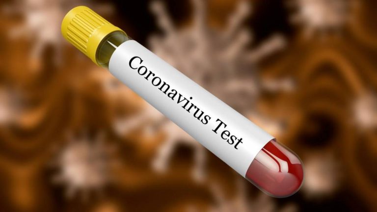 Coronavírus: Jacareí tem 37 óbitos, 621 casos confirmados e 384 recuperados